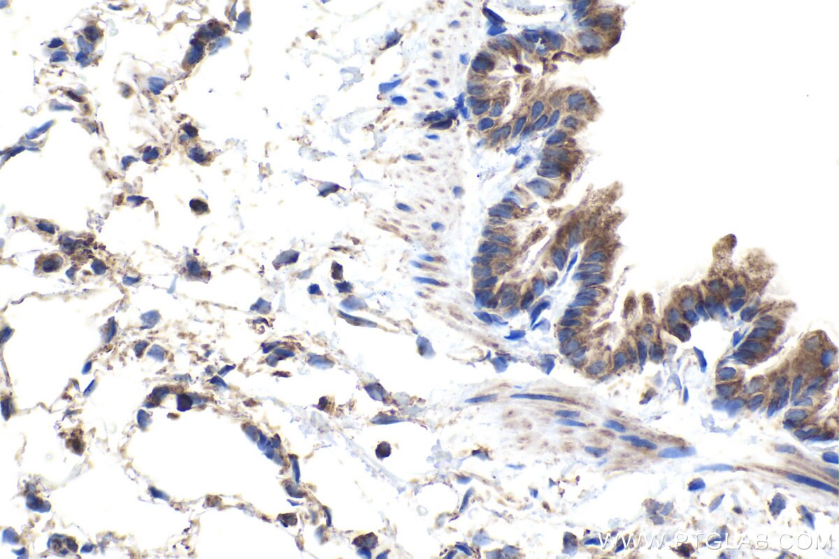 Immunohistochemical analysis of paraffin-embedded rat lung tissue slide using KHC1468 (LPXN IHC Kit).