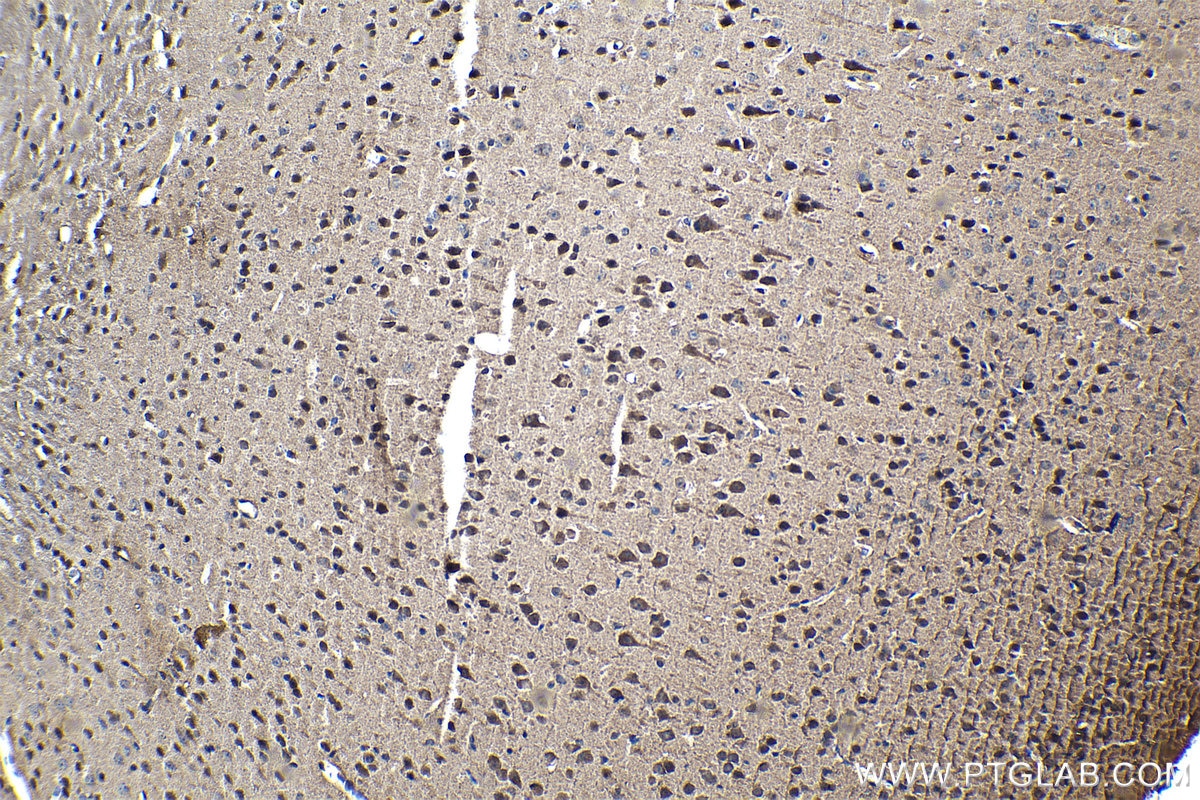 Immunohistochemical analysis of paraffin-embedded mouse brain tissue slide using KHC1284 (LRCH1 IHC Kit).