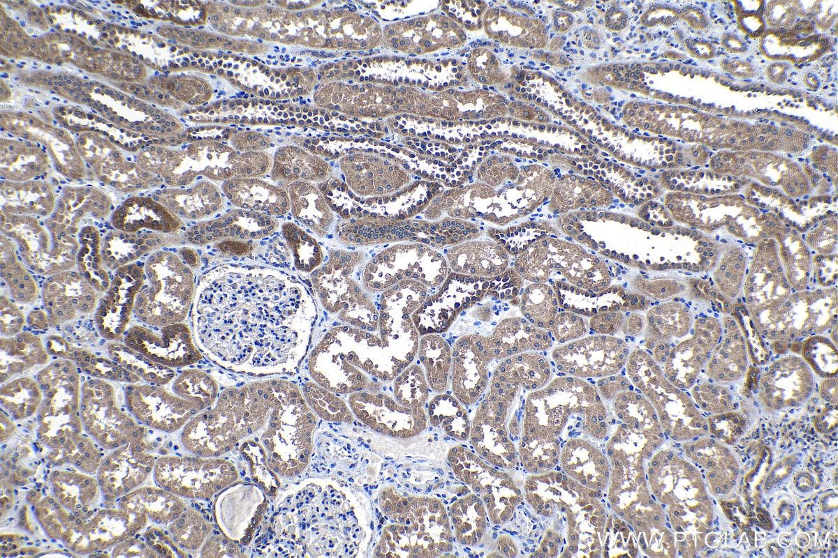 Immunohistochemical analysis of paraffin-embedded human kidney tissue slide using KHC1284 (LRCH1 IHC Kit).