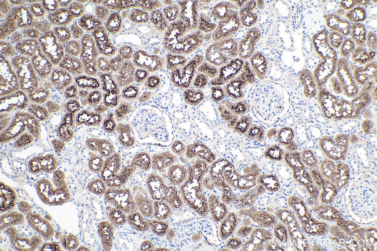 Immunohistochemical analysis of paraffin-embedded human kidney tissue slide using KHC0220 (LRP2-Specific IHC Kit).