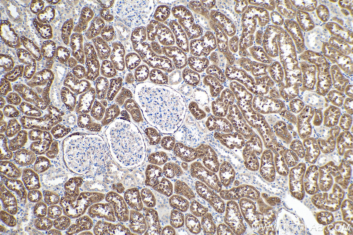 Immunohistochemical analysis of paraffin-embedded human kidney tissue slide using KHC0222 (LRPAP1 IHC Kit).