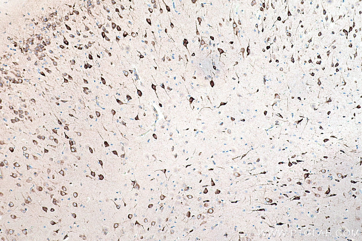 Immunohistochemical analysis of paraffin-embedded rat brain tissue slide using KHC0222 (LRPAP1 IHC Kit).