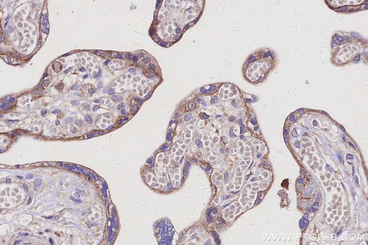 Immunohistochemical analysis of paraffin-embedded human placenta tissue slide using KHC3115 (LRRC1 IHC Kit). Immunohistochemical analysis of paraffin-embedded human placenta tissue slide using KHC3115 (LRRC1 IHC Kit).
