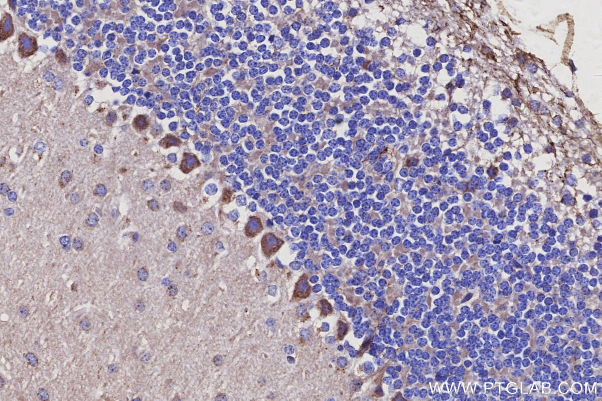 Immunohistochemical analysis of paraffin-embedded mouse cerebellum tissue slide using KHC3115 (LRRC1 IHC Kit). Immunohistochemical analysis of paraffin-embedded mouse cerebellum tissue slide using KHC3115 (LRRC1 IHC Kit).