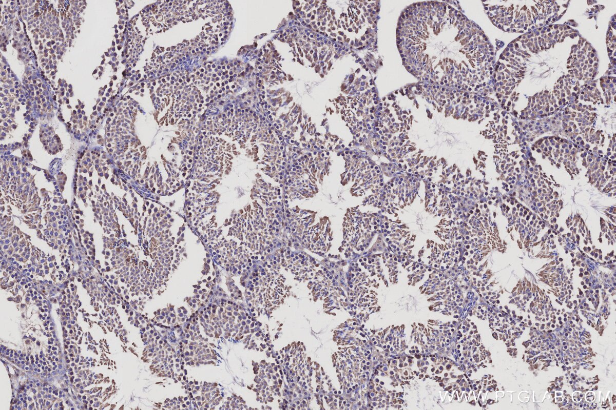 Immunohistochemical analysis of paraffin-embedded mouse testis tissue slide using KHC3115 (LRRC1 IHC Kit). Immunohistochemical analysis of paraffin-embedded mouse testis tissue slide using KHC3115 (LRRC1 IHC Kit).