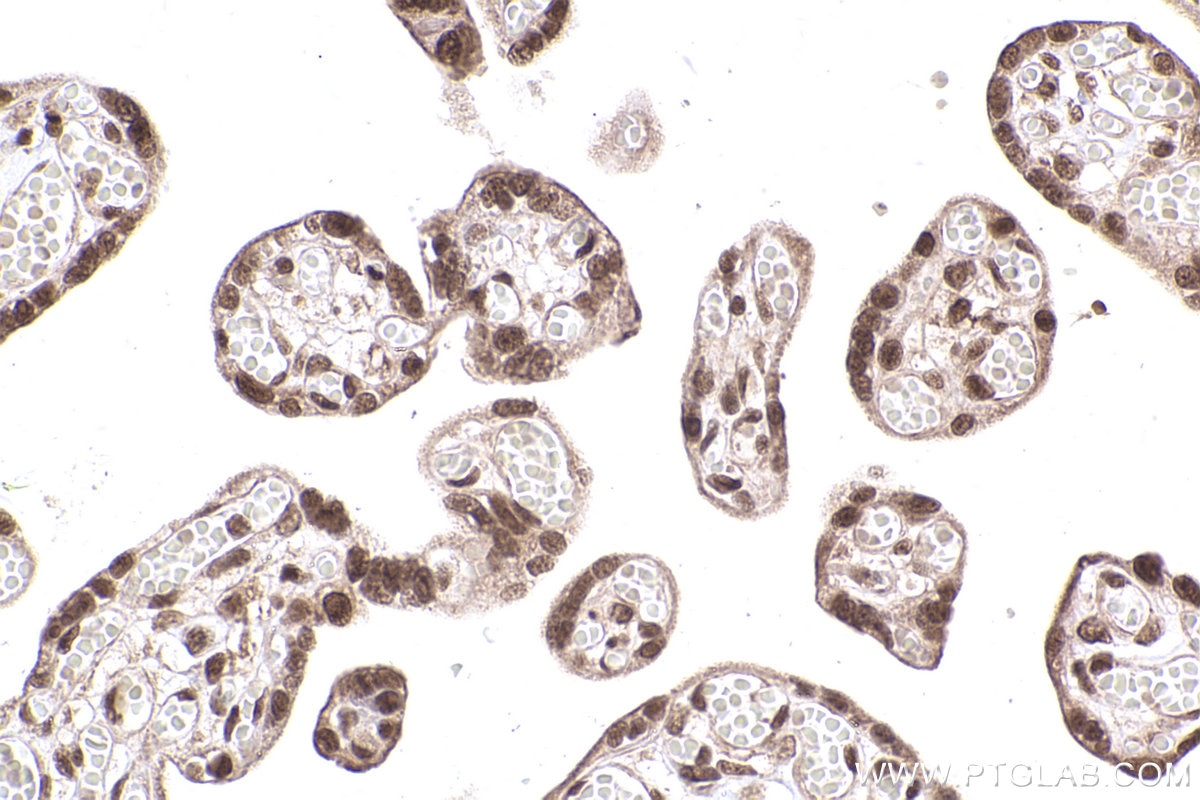 Immunohistochemical analysis of paraffin-embedded human placenta tissue slide using KHC2485 (LRRC41 IHC Kit).