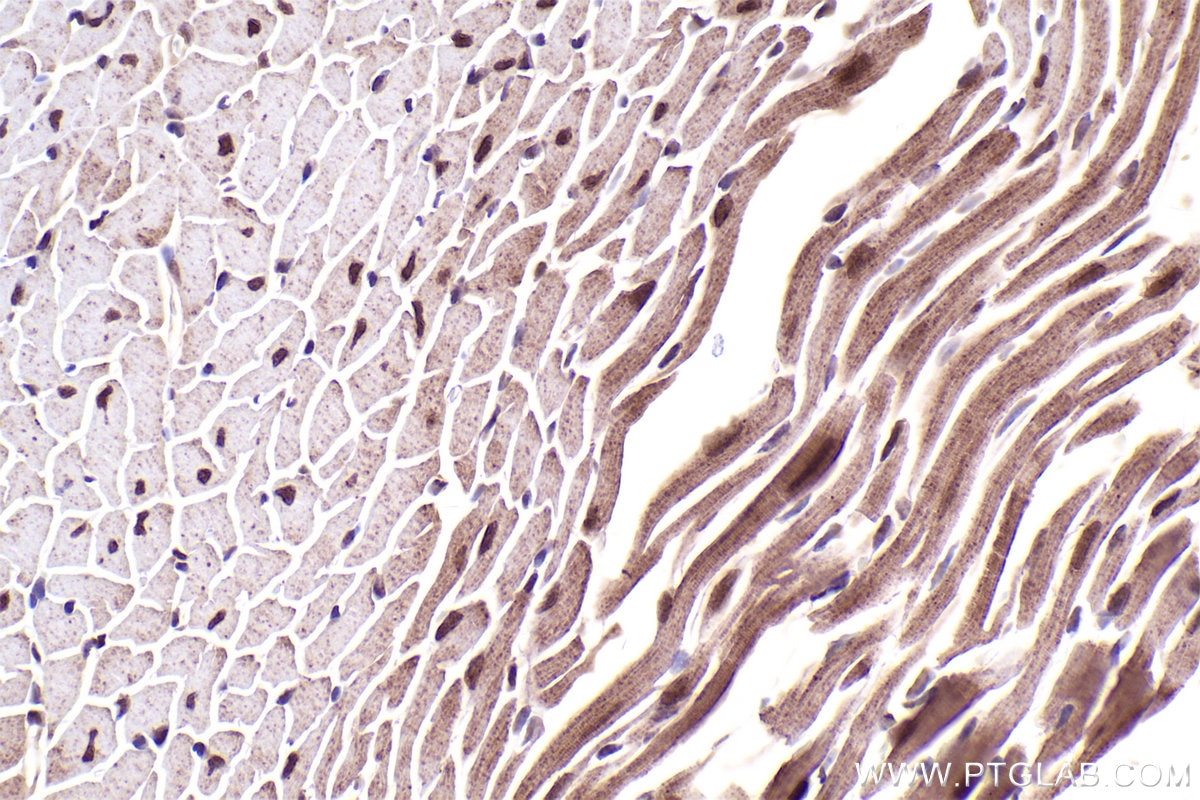 Immunohistochemical analysis of paraffin-embedded mouse heart tissue slide using KHC2485 (LRRC41 IHC Kit).