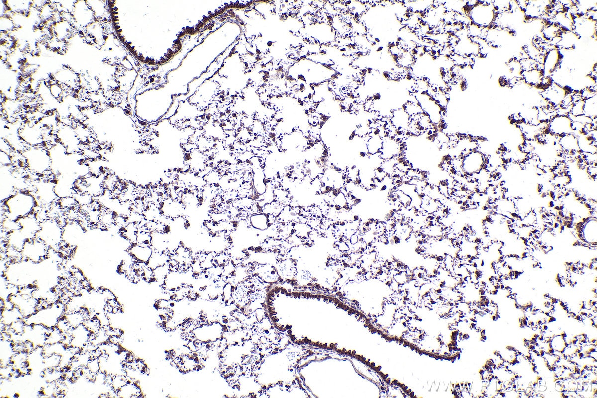 Immunohistochemical analysis of paraffin-embedded mouse lung tissue slide using KHC2485 (LRRC41 IHC Kit).