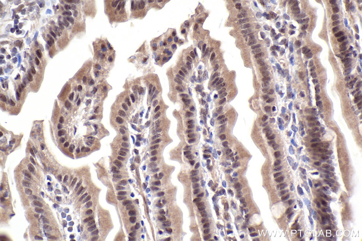 Immunohistochemical analysis of paraffin-embedded mouse small intestine tissue slide using KHC2485 (LRRC41 IHC Kit).