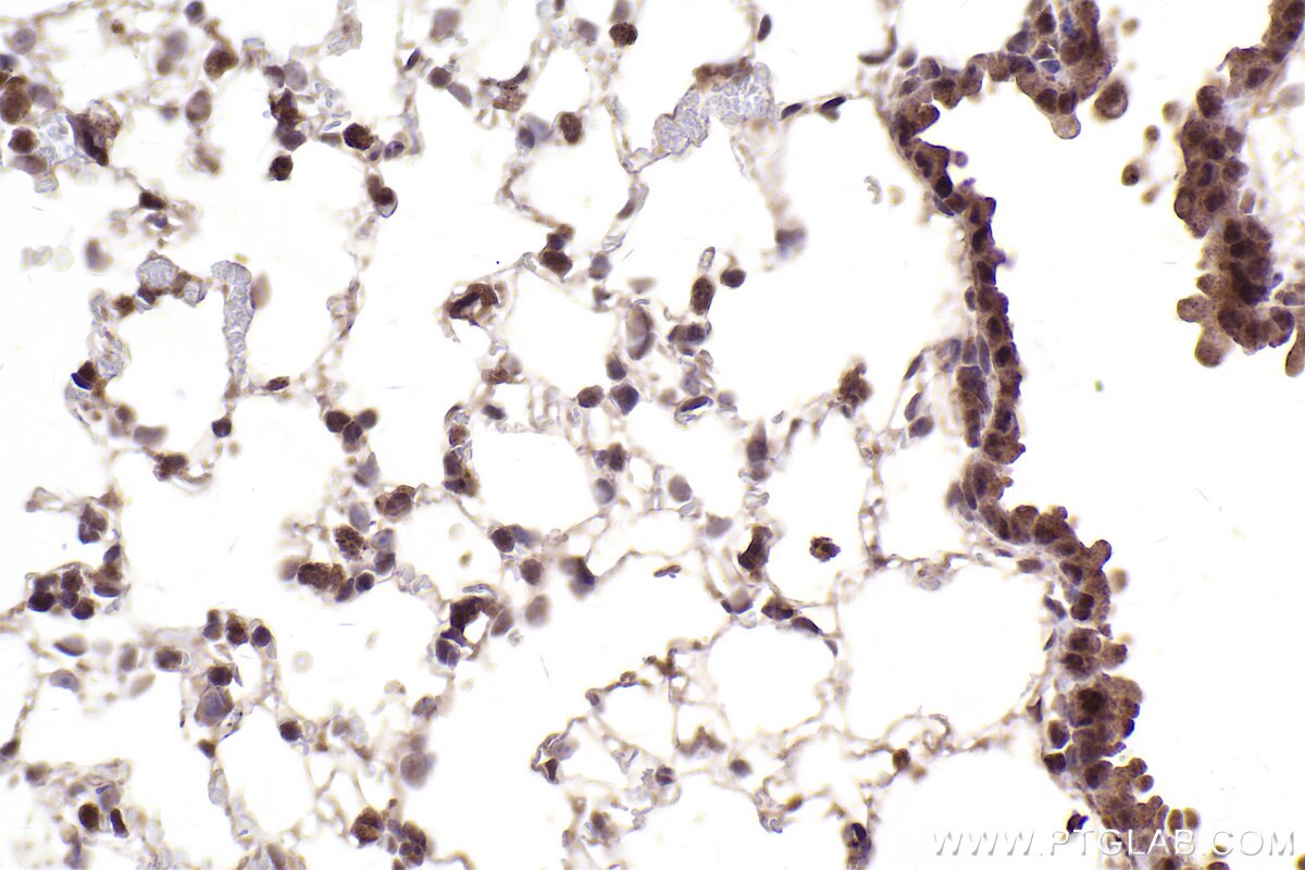 Immunohistochemical analysis of paraffin-embedded rat lung tissue slide using KHC2485 (LRRC41 IHC Kit).