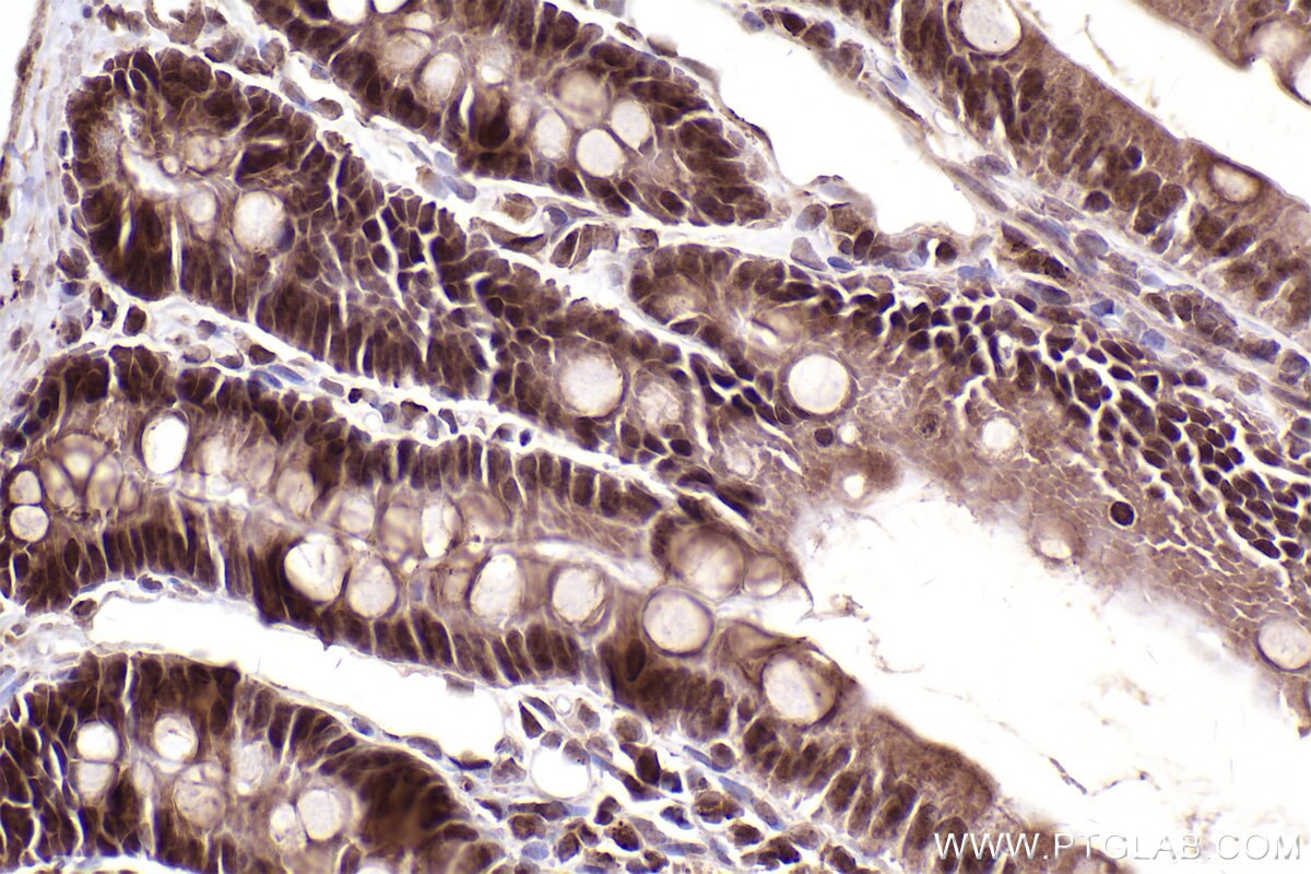 Immunohistochemical analysis of paraffin-embedded rat small intestine tissue slide using KHC2485 (LRRC41 IHC Kit).