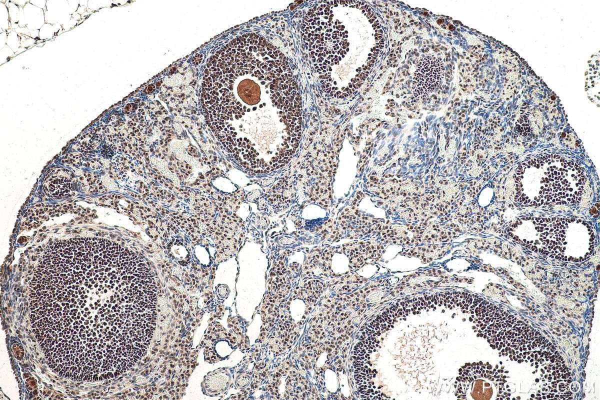 Immunohistochemical analysis of paraffin-embedded mouse ovary tissue slide using KHC0840 (LSM5 IHC Kit).