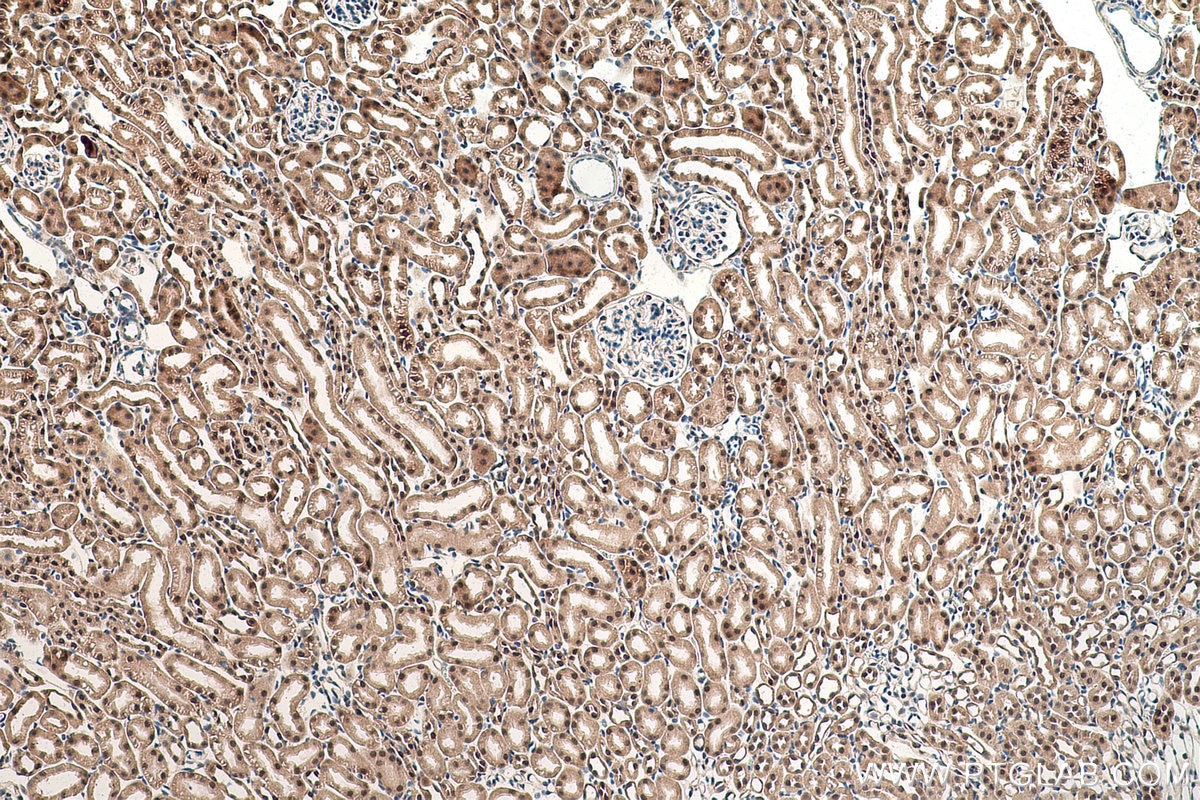 Immunohistochemical analysis of paraffin-embedded mouse kidney tissue slide using KHC0840 (LSM5 IHC Kit).