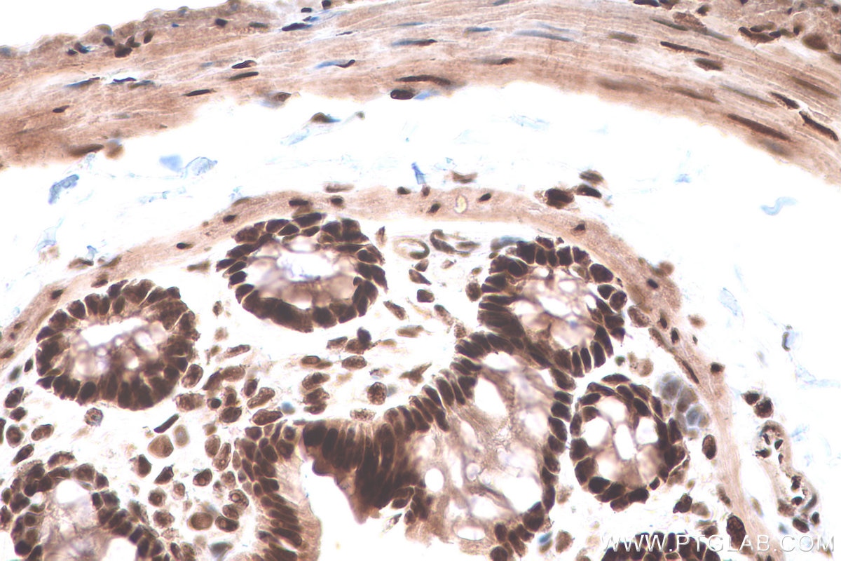 Immunohistochemical analysis of paraffin-embedded rat colon tissue slide using KHC0827 (LSM8 IHC Kit).