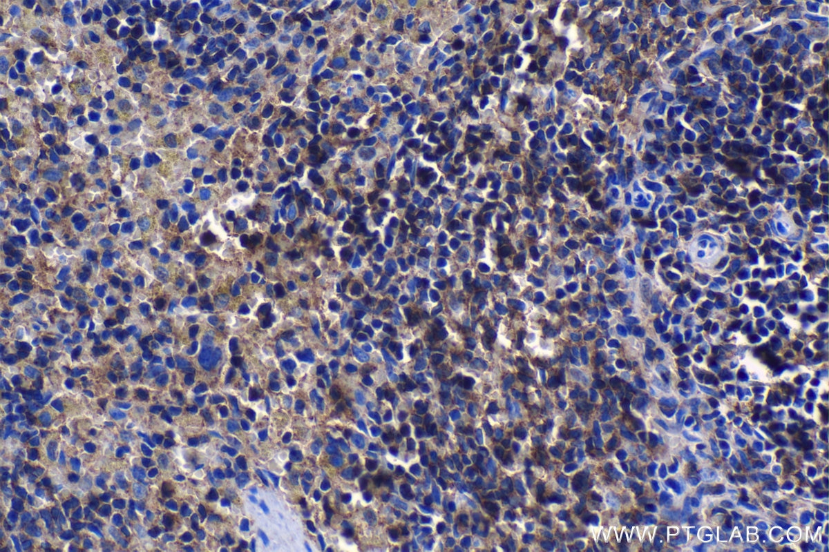 Immunohistochemical analysis of paraffin-embedded rat spleen tissue slide using KHC1219 (LYN IHC Kit).