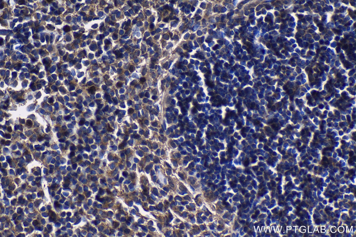 Immunohistochemical analysis of paraffin-embedded mouse spleen tissue slide using KHC1219 (LYN IHC Kit).