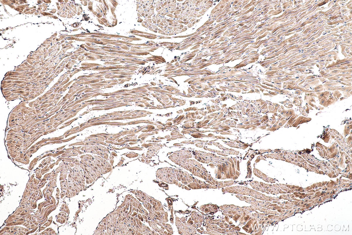 Immunohistochemical analysis of paraffin-embedded rat heart tissue slide using KHC0956 (LZTFL1 IHC Kit).