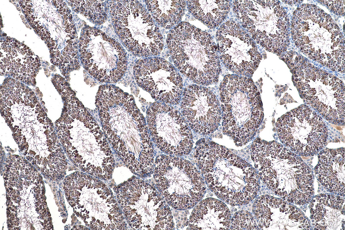 Immunohistochemical analysis of paraffin-embedded mouse testis tissue slide using KHC0956 (LZTFL1 IHC Kit).