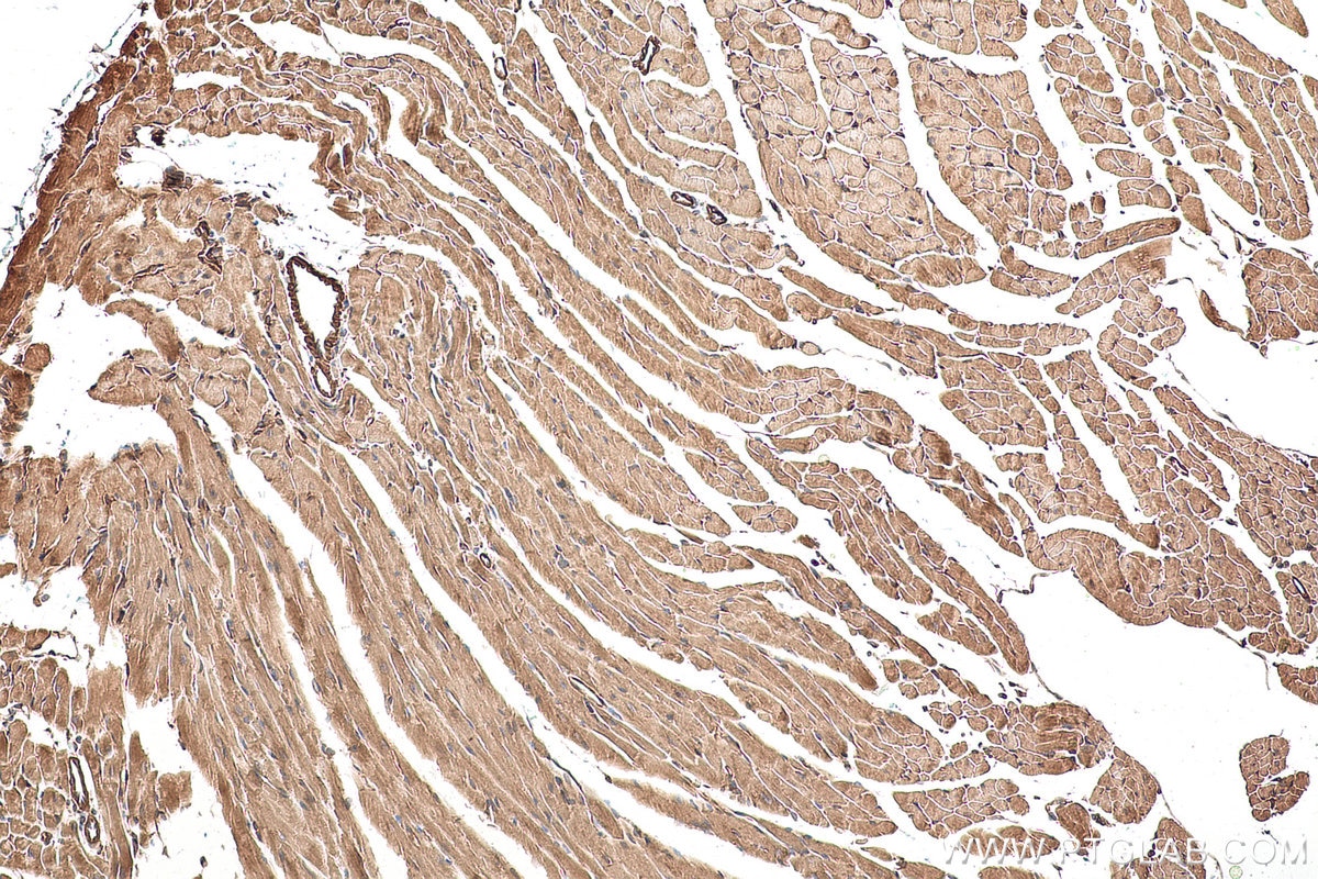 Immunohistochemical analysis of paraffin-embedded mouse heart tissue slide using KHC0956 (LZTFL1 IHC Kit).