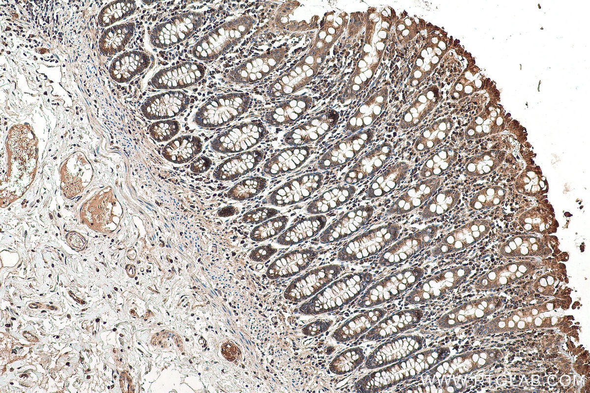 Immunohistochemical analysis of paraffin-embedded human colon tissue slide using KHC0956 (LZTFL1 IHC Kit).