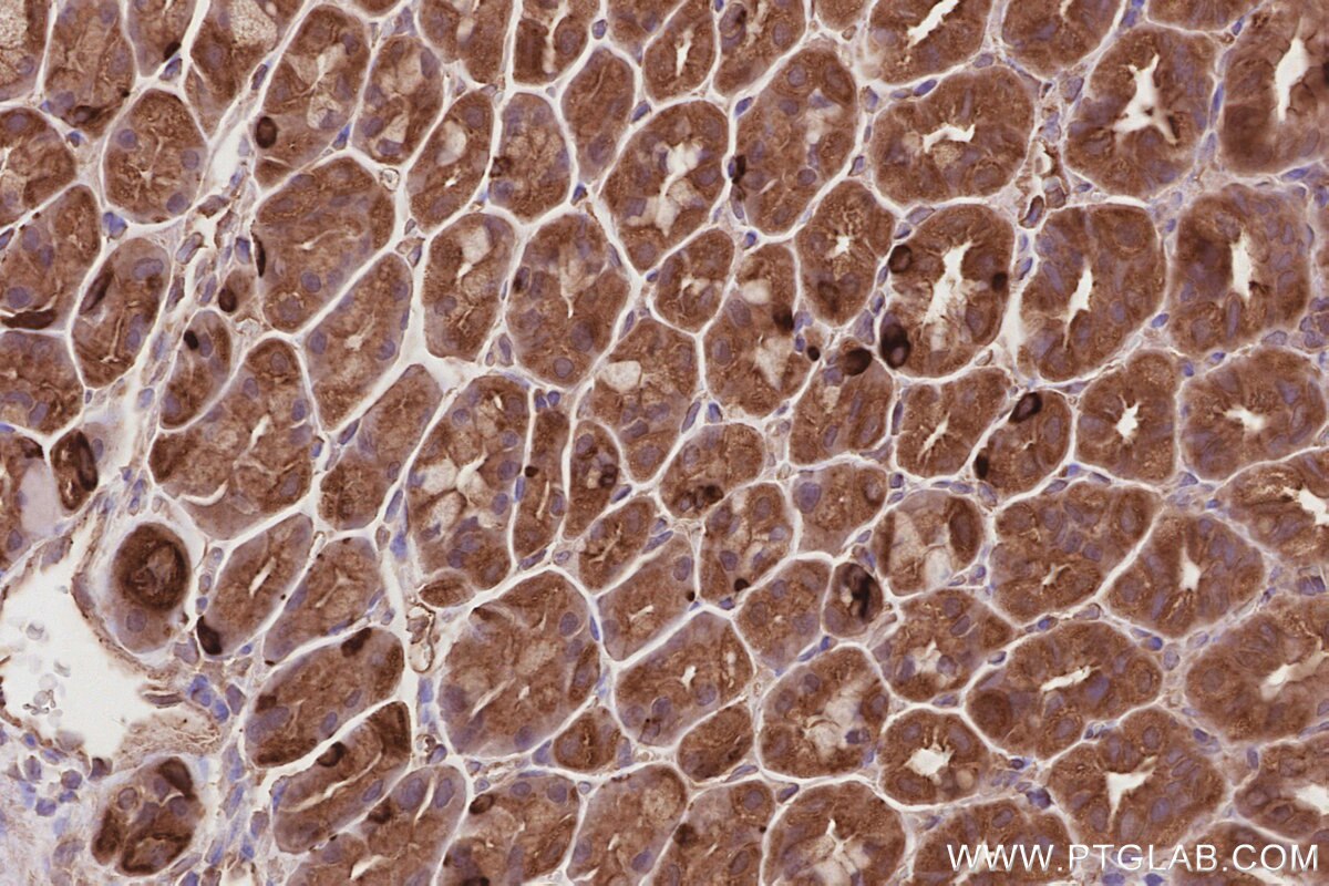 Immunohistochemical analysis of paraffin-embedded mouse stomach tissue slide using KHC2856 (LZTS2 IHC Kit).