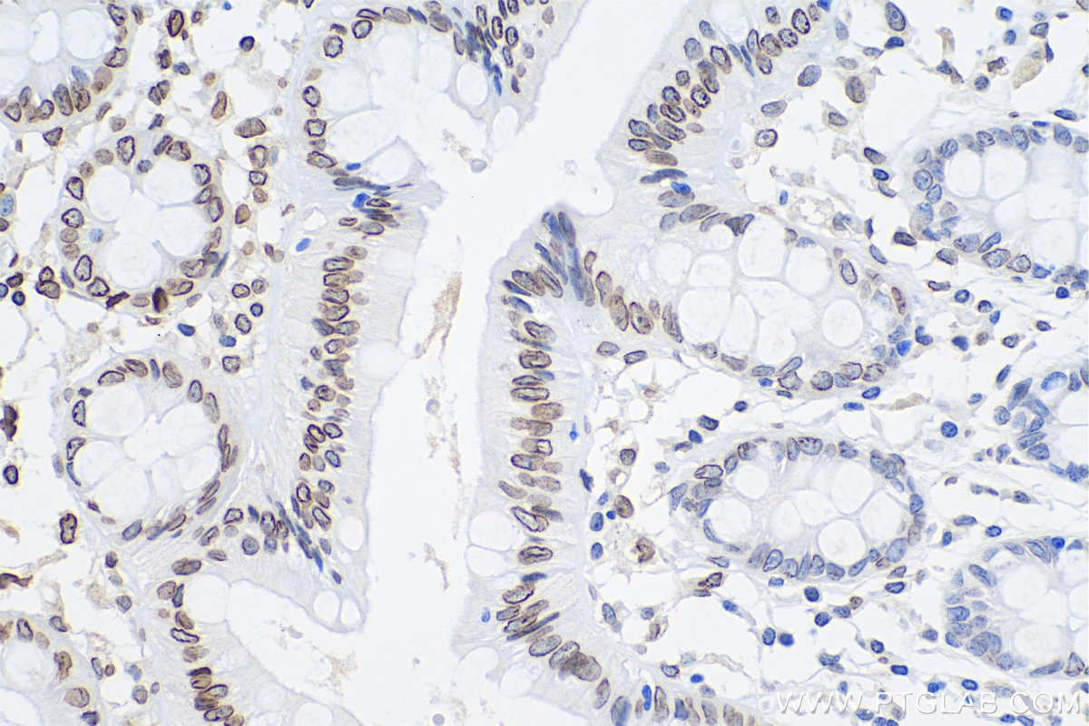 Immunohistochemical analysis of paraffin-embedded human colon tissue slide using KHC0311 (Lamin A/C IHC Kit).