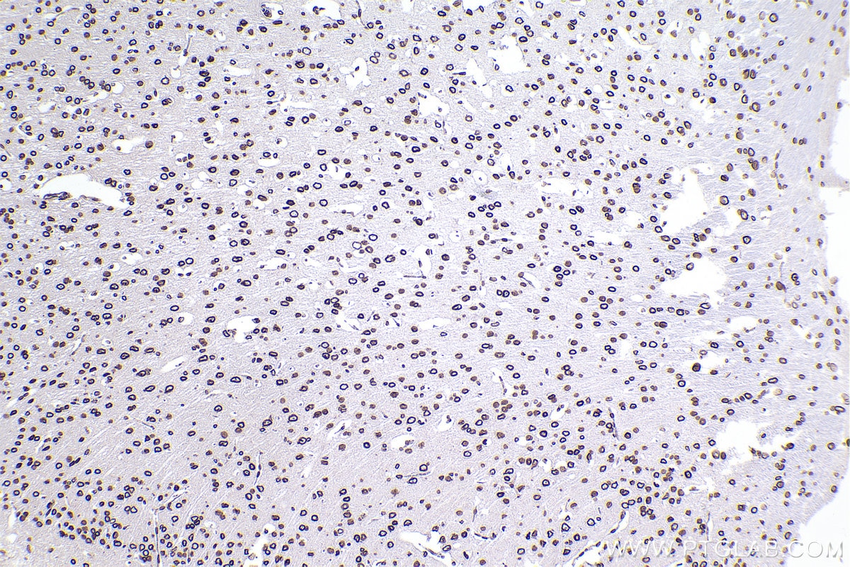 Immunohistochemical analysis of paraffin-embedded mouse brain tissue slide using KHC2389 (Lamin B2 IHC Kit).