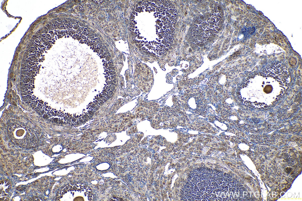 Immunohistochemical analysis of paraffin-embedded mouse ovary tissue slide using KHC0631 (MAD2L1 IHC Kit).