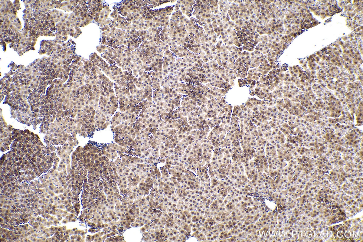 Immunohistochemical analysis of paraffin-embedded rat liver tissue slide using KHC0631 (MAD2L1 IHC Kit).