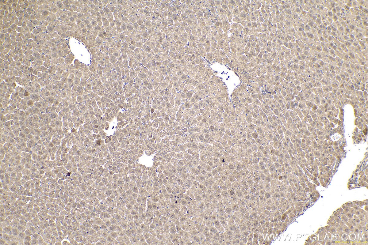 Immunohistochemical analysis of paraffin-embedded mouse liver tissue slide using KHC0631 (MAD2L1 IHC Kit).