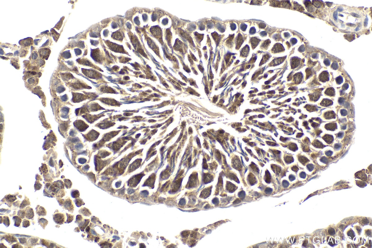 Immunohistochemical analysis of paraffin-embedded rat testis tissue slide using KHC1987 (MAD2L2 IHC Kit).