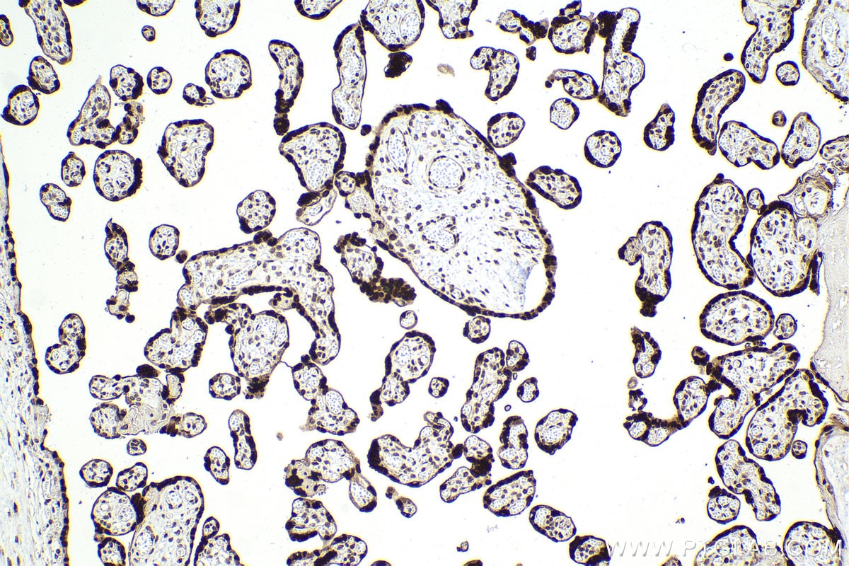 Immunohistochemical analysis of paraffin-embedded human placenta tissue slide using KHC1999 (MAFF IHC Kit).