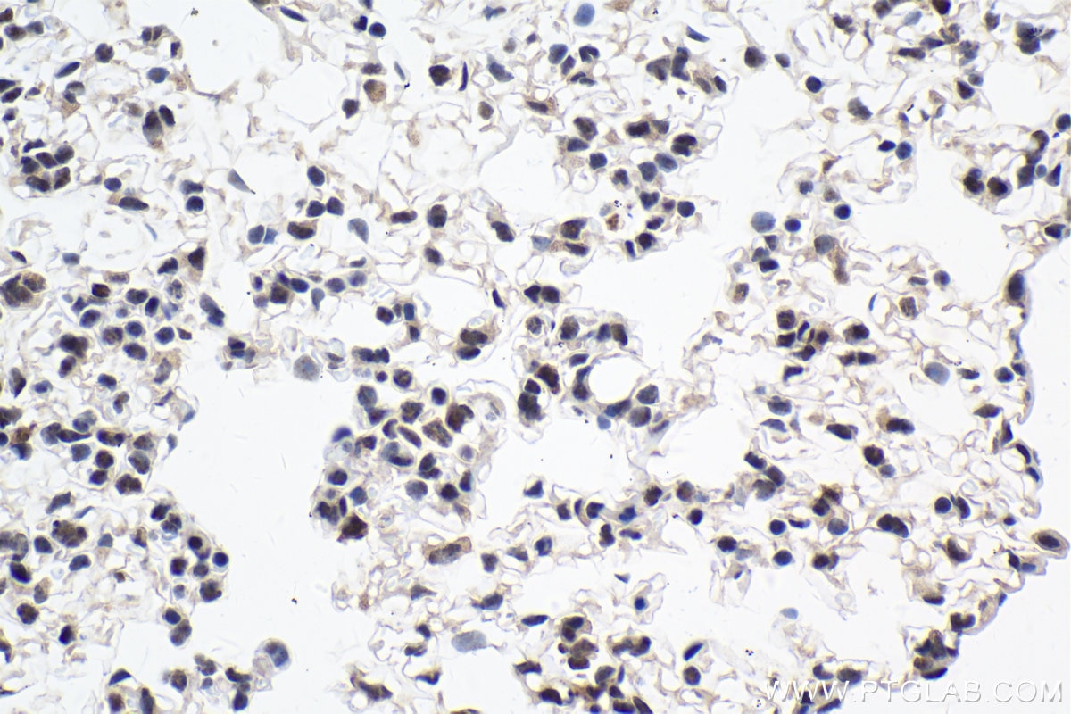 Immunohistochemical analysis of paraffin-embedded mouse lung tissue slide using KHC1999 (MAFF IHC Kit).