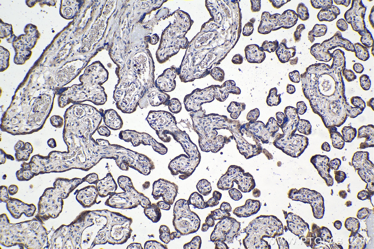 Immunohistochemical analysis of paraffin-embedded human placenta tissue slide using KHC1075 (MAGEA3 IHC Kit).