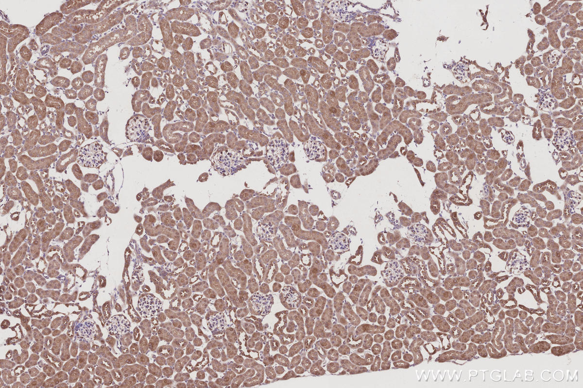 Immunohistochemical analysis of paraffin-embedded mouse kidney tissue slide using KHC3043 (MAGED2 IHC Kit). Immunohistochemical analysis of paraffin-embedded mouse kidney tissue slide using KHC3043 (MAGED2 IHC Kit).