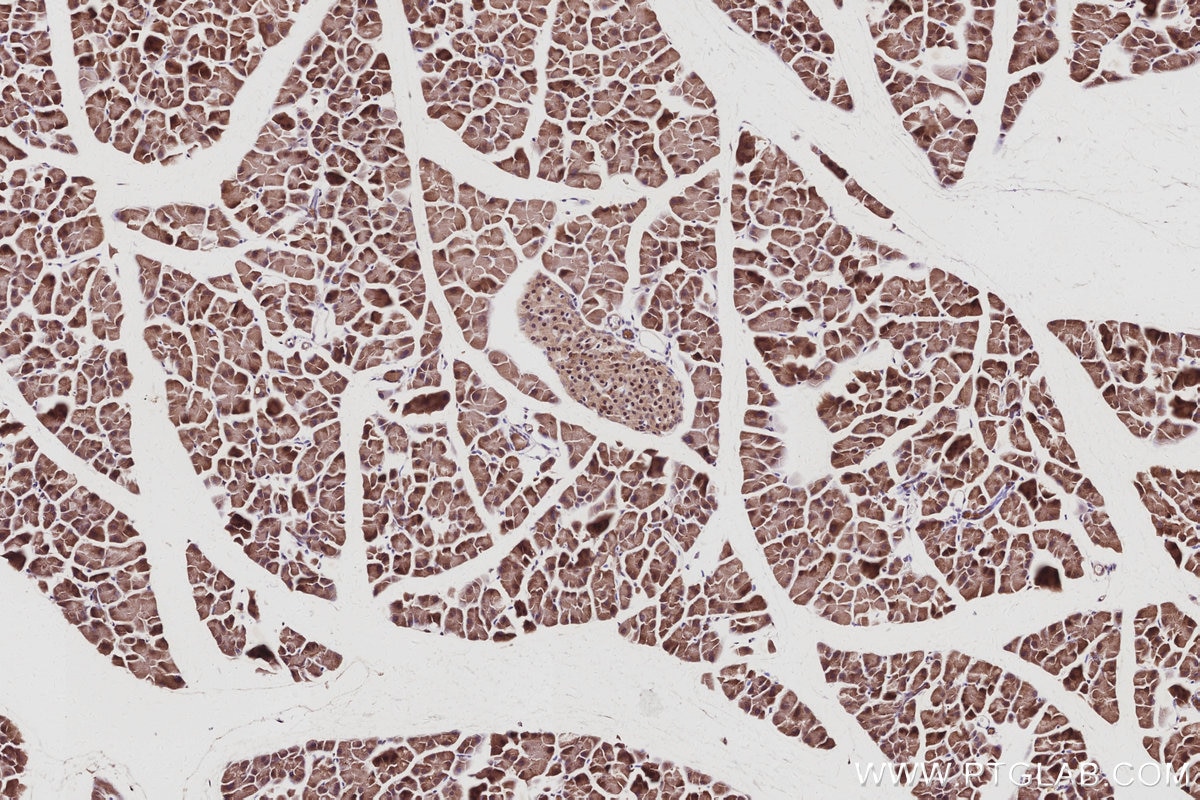 Immunohistochemical analysis of paraffin-embedded mouse pancreas tissue slide using KHC3043 (MAGED2 IHC Kit). Immunohistochemical analysis of paraffin-embedded mouse pancreas tissue slide using KHC3043 (MAGED2 IHC Kit).