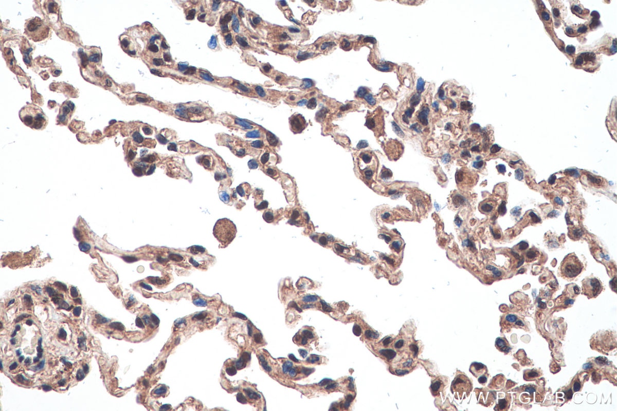 Immunohistochemical analysis of paraffin-embedded human lung tissue slide using KHC0856 (MAGOH IHC Kit).