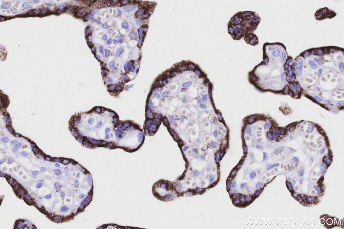 Immunohistochemical analysis of paraffin-embedded human placenta tissue slide using KHC3204 (MAOB IHC Kit). Immunohistochemical analysis of paraffin-embedded human placenta tissue slide using KHC3204 (MAOB IHC Kit).