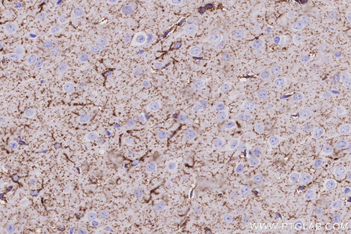 Immunohistochemical analysis of paraffin-embedded mouse brain tissue slide using KHC3204 (MAOB IHC Kit). Immunohistochemical analysis of paraffin-embedded mouse brain tissue slide using KHC3204 (MAOB IHC Kit).