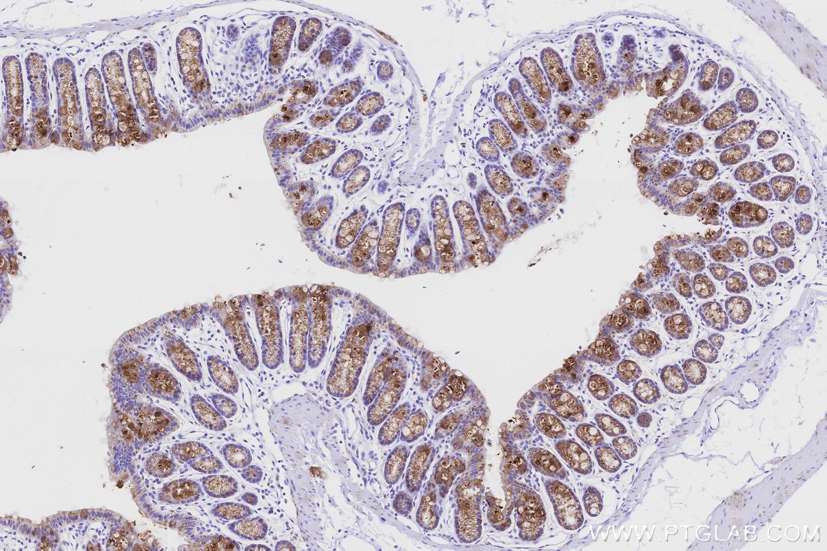 Immunohistochemical analysis of paraffin-embedded mouse colon tissue slide using KHC3204 (MAOB IHC Kit). Immunohistochemical analysis of paraffin-embedded mouse colon tissue slide using KHC3204 (MAOB IHC Kit).