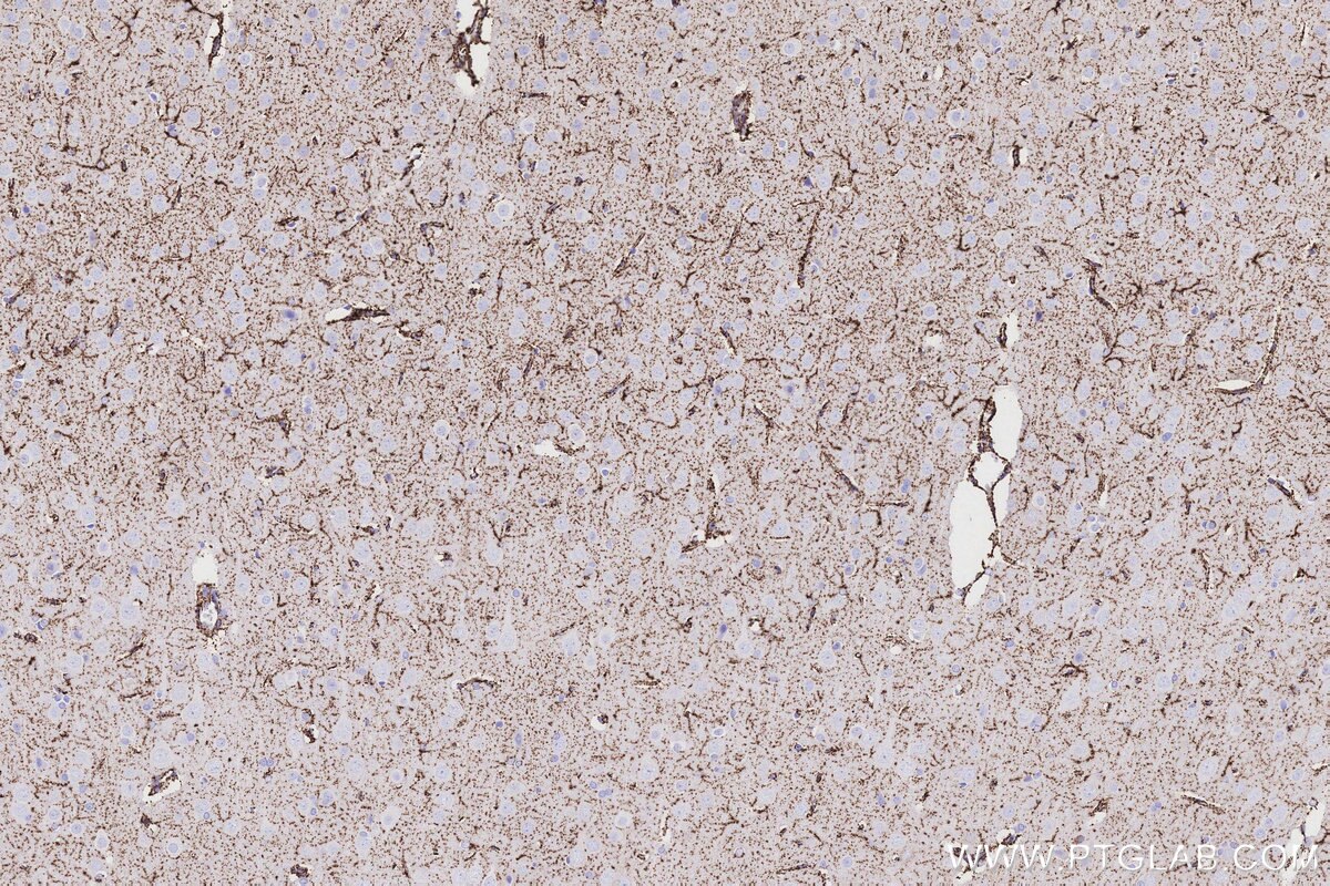 Immunohistochemical analysis of paraffin-embedded rat brain tissue slide using KHC3204 (MAOB IHC Kit). Immunohistochemical analysis of paraffin-embedded rat brain tissue slide using KHC3204 (MAOB IHC Kit).