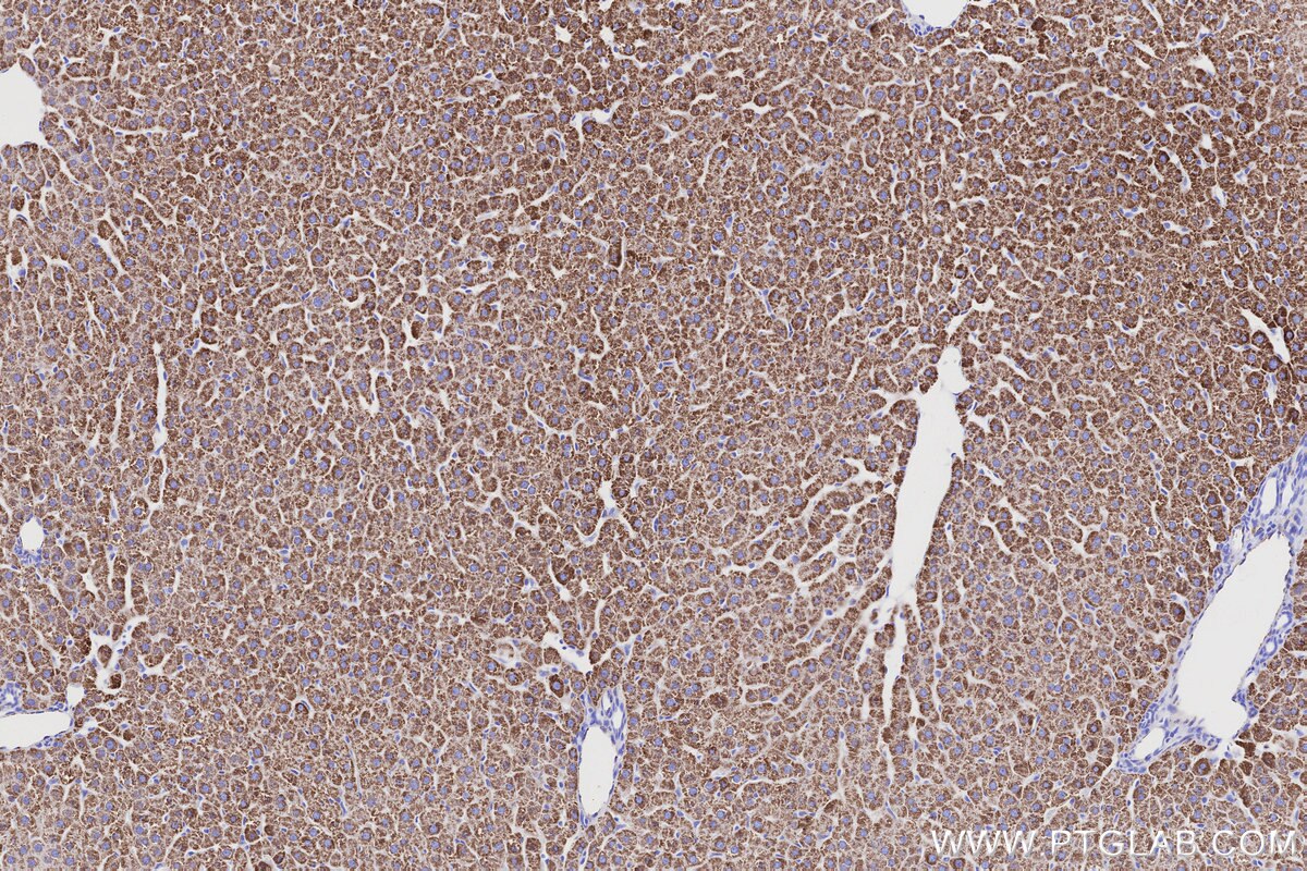 Immunohistochemical analysis of paraffin-embedded rat liver tissue slide using KHC3204 (MAOB IHC Kit). Immunohistochemical analysis of paraffin-embedded rat liver tissue slide using KHC3204 (MAOB IHC Kit).