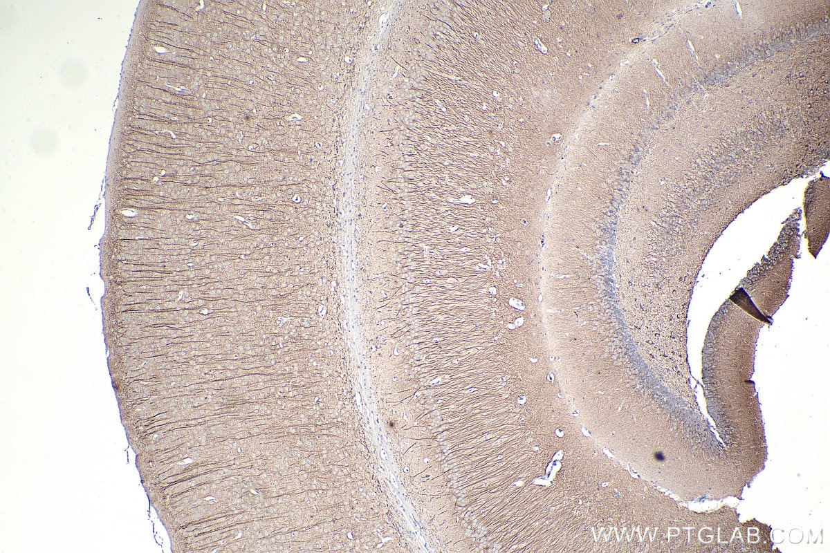 Immunohistochemical analysis of paraffin-embedded mouse brain tissue slide using KHC0043 (MAP2 IHC Kit).