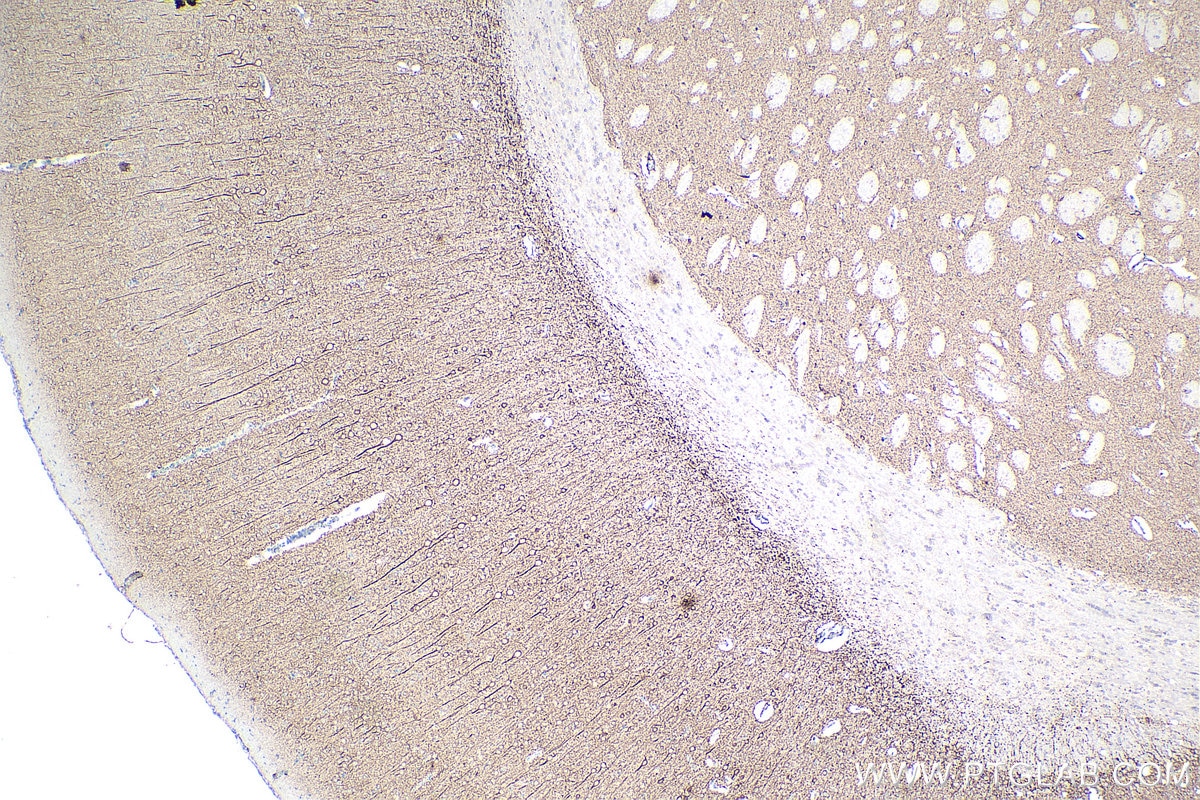 Immunohistochemical analysis of paraffin-embedded rat brain tissue slide using KHC0043 (MAP2 IHC Kit).