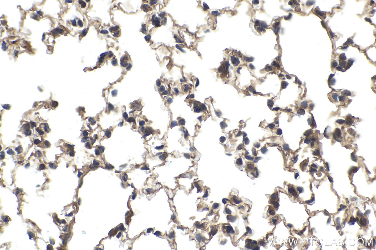 Immunohistochemical analysis of paraffin-embedded mouse lung tissue slide using KHC1670 (MAP2K1/MEK1 IHC Kit).