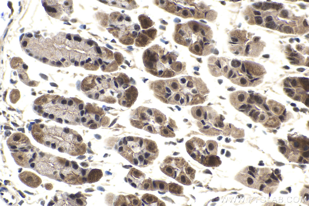 Immunohistochemical analysis of paraffin-embedded mouse stomach tissue slide using KHC1670 (MAP2K1/MEK1 IHC Kit).