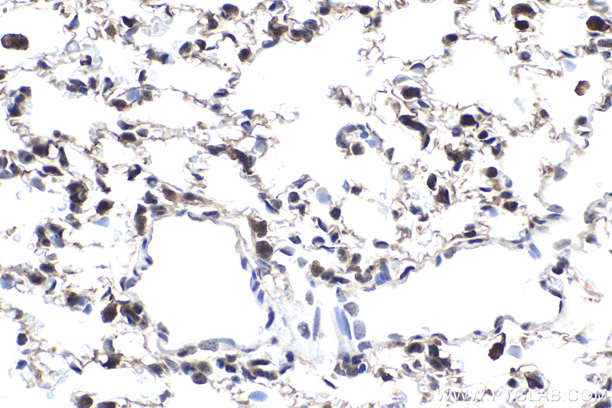 Immunohistochemical analysis of paraffin-embedded rat lung tissue slide using KHC1670 (MAP2K1/MEK1 IHC Kit).