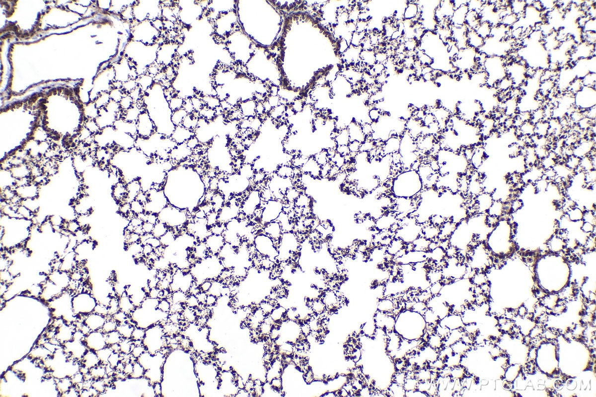 Immunohistochemical analysis of paraffin-embedded mouse lung tissue slide using KHC2080 (MAP3K7/TAK1 IHC Kit).