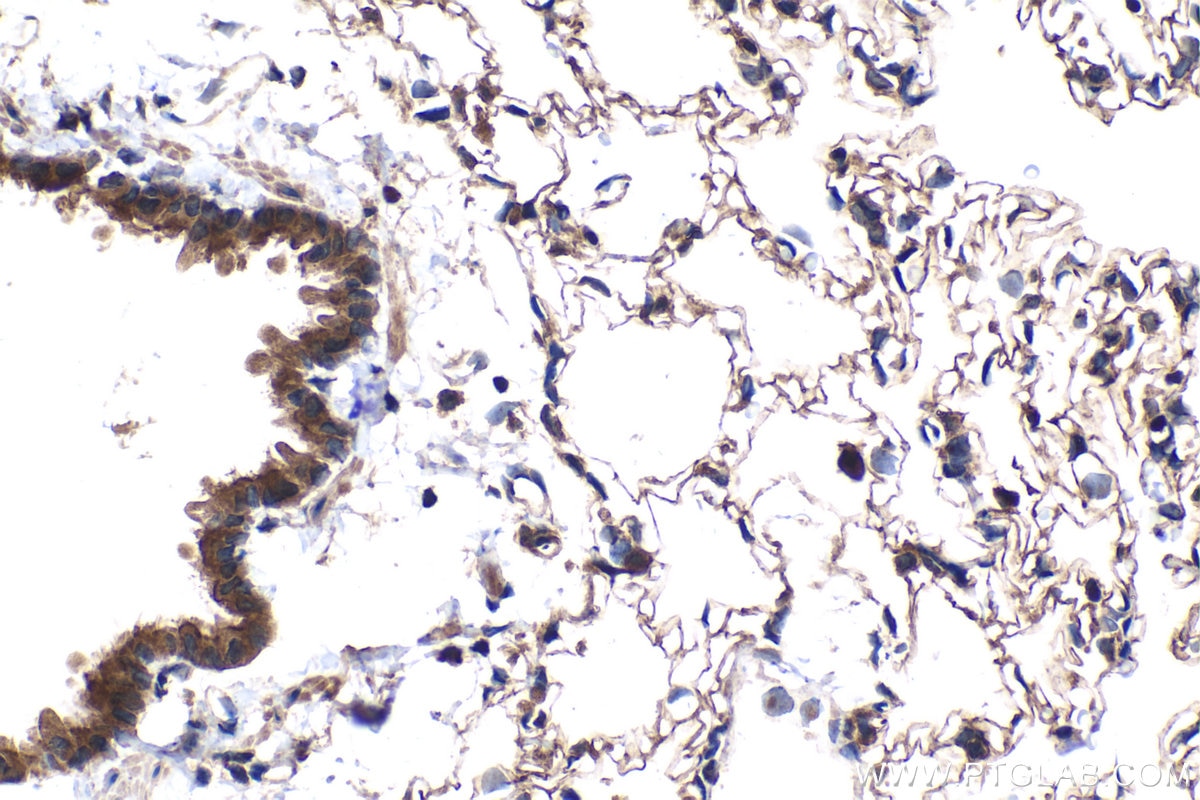 Immunohistochemical analysis of paraffin-embedded rat lung tissue slide using KHC2080 (MAP3K7/TAK1 IHC Kit).