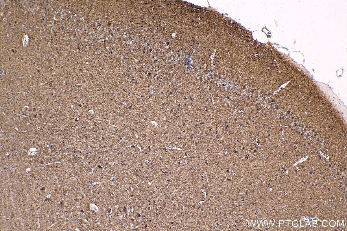 Immunohistochemical analysis of paraffin-embedded mouse brain tissue slide using KHC1626 (MAPK10 IHC Kit).